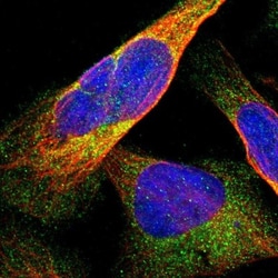 DDHD2 Antibody, Novus Biologicals:Antibodies:Primary Antibodies